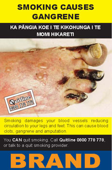 Image of the Smoking causes gangrene cigarette packet design - back. 